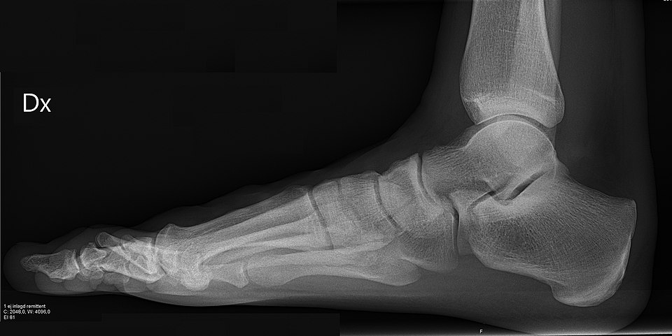 XR Right Foot thumbnail
